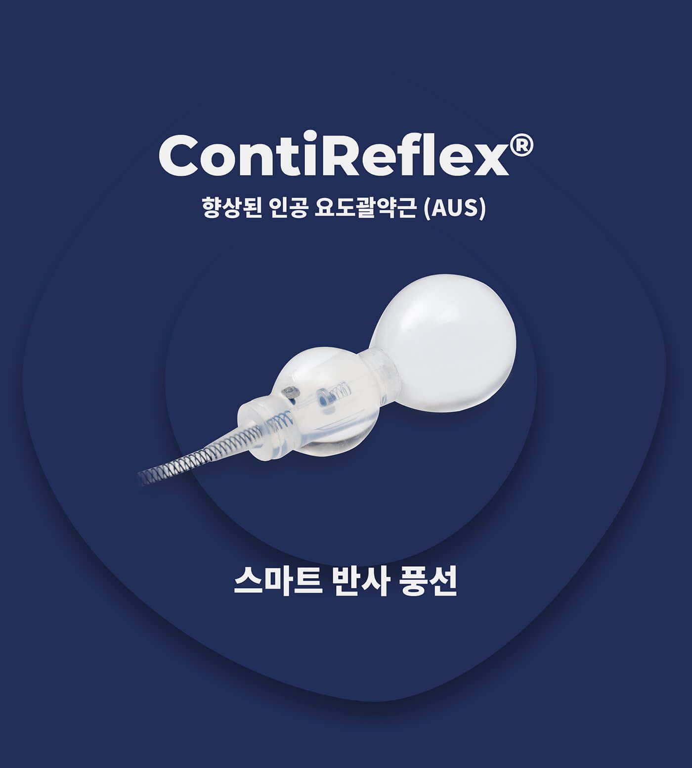 ContiReflex Artificial Urinary Sphincter